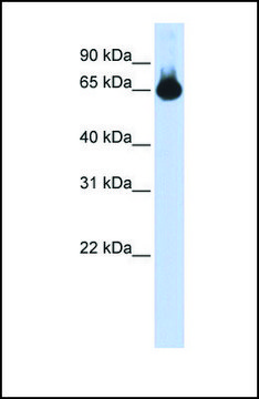 Anti-FOXG1, (N-terminal) antibody produced in rabbit affinity isolated antibody