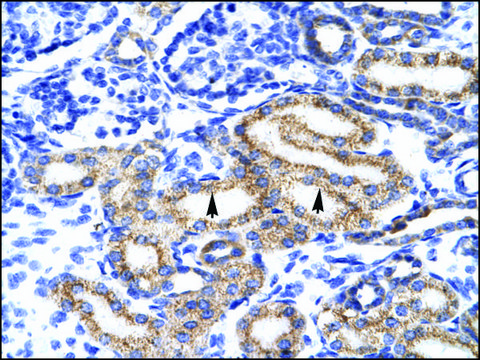 Anti-MEIS2 antibody produced in rabbit IgG fraction of antiserum