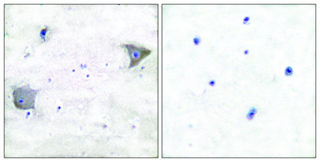 Anti-PDGFR &#945; antibody produced in rabbit affinity isolated antibody