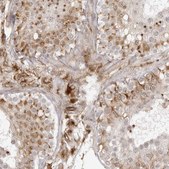 Anti-TCTEX1D1 antibody produced in rabbit Prestige Antibodies® Powered by Atlas Antibodies, affinity isolated antibody, buffered aqueous glycerol solution
