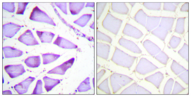 Anti-S6 Ribosomal Protein, C-Terminal antibody produced in rabbit affinity isolated antibody