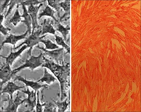 Porcine Aortic Smooth Muscle Cells: PAOSMC (Cryovial)