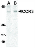 Anti-CCR3 antibody produced in rabbit affinity isolated antibody, buffered aqueous solution