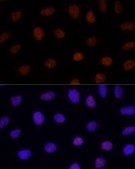 Anti-GLI2 antibody produced in rabbit