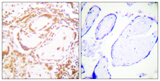 Anti-Histone H4 antibody produced in rabbit affinity isolated antibody