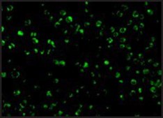 Anti-TSC1 (ab2) antibody produced in rabbit affinity isolated antibody, buffered aqueous solution