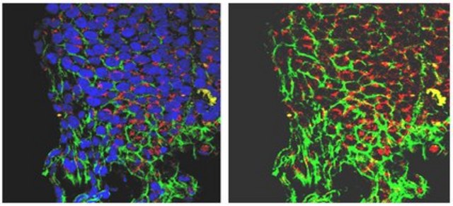 Anti-Dynamin related protein 1 (Drp1) Antibody from rabbit, purified by affinity chromatography