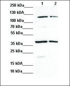 Anti-CCND1 (ab2) antibody produced in rabbit affinity isolated antibody