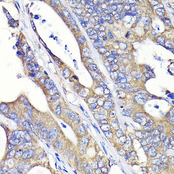 Anti-Fatty Acid Synthase (FASN) antibody produced in rabbit