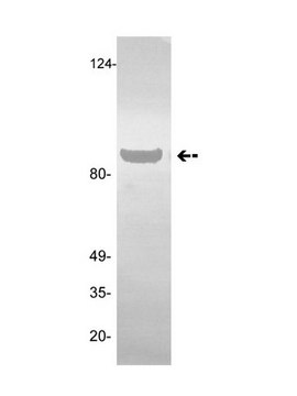 Anti-Plasminogen/Angiostatin Antibody, clone GMA-013 clone GMA-013, Upstate&#174;, from mouse