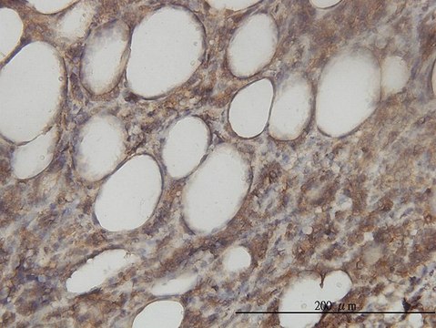 Monoclonal Anti-ACY1 antibody produced in mouse clone 4F1-B7, purified immunoglobulin, buffered aqueous solution