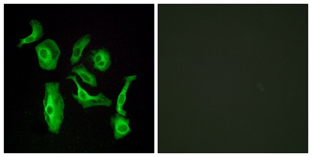 Anti-GPR133 antibody produced in rabbit affinity isolated antibody