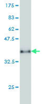 Monoclonal Anti-CXCL5 antibody produced in mouse clone M1, purified immunoglobulin, buffered aqueous solution