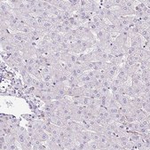 Anti-MYO5C antibody produced in rabbit Prestige Antibodies® Powered by Atlas Antibodies, affinity isolated antibody