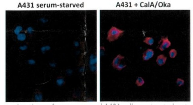 抗-磷酸苏氨酸抗体，克隆RM102 clone RM102, from rabbit, purified by affinity chromatography