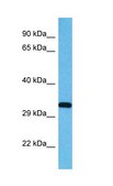 Anti-USF1 antibody produced in rabbit affinity isolated antibody