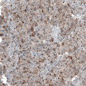 Anti-TMEM255A antibody produced in rabbit Prestige Antibodies® Powered by Atlas Antibodies, affinity isolated antibody, buffered aqueous glycerol solution