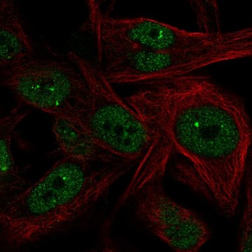 Anti-NME5 antibody produced in rabbit Prestige Antibodies&#174; Powered by Atlas Antibodies, affinity isolated antibody