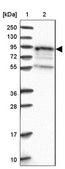 Anti-EPS8L1 antibody produced in rabbit Prestige Antibodies® Powered by Atlas Antibodies, affinity isolated antibody, buffered aqueous glycerol solution