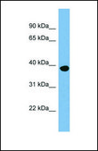 Anti-OAS1, (N-terminal) antibody produced in rabbit affinity isolated antibody