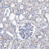 Anti-ACKR1 antibody produced in rabbit Prestige Antibodies® Powered by Atlas Antibodies, affinity isolated antibody, buffered aqueous glycerol solution