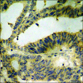 Anti-phospho-Catenin-β (pTyr489) antibody produced in rabbit affinity isolated antibody