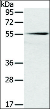 Anti-SLC16A10 antibody produced in rabbit affinity isolated antibody