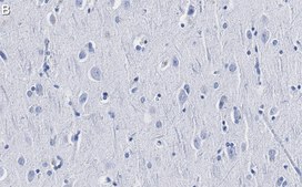 Anti-Catenin-α 2 Antibody, clone 3F7 ZooMAb® Rabbit Monoclonal recombinant, expressed in HEK 293 cells