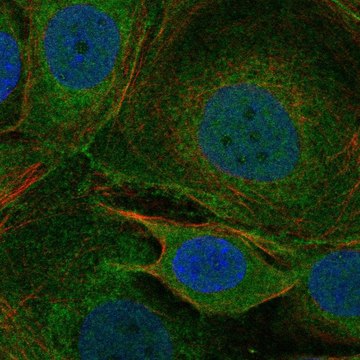 Anti-Cacna1I Antibody Produced In Rabbit Prestige Antibodies&#174; Powered by Atlas Antibodies, affinity isolated antibody, buffered aqueous glycerol solution