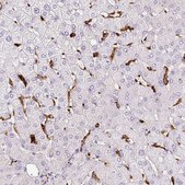 Anti-HLA-DRA antibody produced in rabbit Prestige Antibodies® Powered by Atlas Antibodies, affinity isolated antibody, buffered aqueous glycerol solution