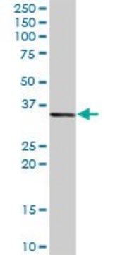 Anti-CEBPE antibody produced in rabbit purified immunoglobulin, buffered aqueous solution