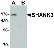 Anti-SHANK3 antibody produced in rabbit affinity isolated antibody, buffered aqueous solution