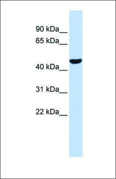 Anti-PTGIS antibody produced in rabbit affinity isolated antibody