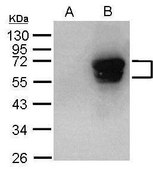 Anti-EV71 antibody produced in rabbit