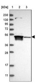 Anti-TSEN2 antibody produced in rabbit Prestige Antibodies® Powered by Atlas Antibodies, affinity isolated antibody, buffered aqueous glycerol solution, ab1