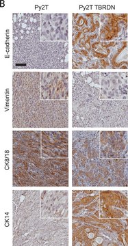 波形蛋白单克隆抗体 小鼠抗 clone LN-6, ascites fluid