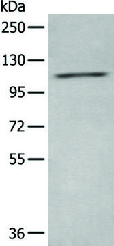 Anti-ADCY2 affinity isolated antibody