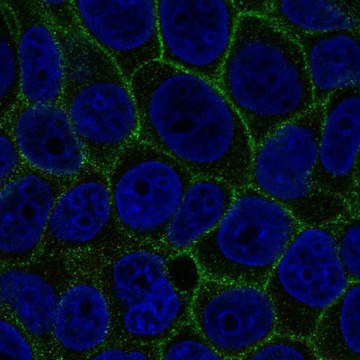 Anti-SLC7A2 antibody produced in rabbit Prestige Antibodies&#174; Powered by Atlas Antibodies, affinity isolated antibody