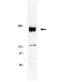 Anti-erbB-2/HER-2 Antibody Upstate&#174;, from rabbit