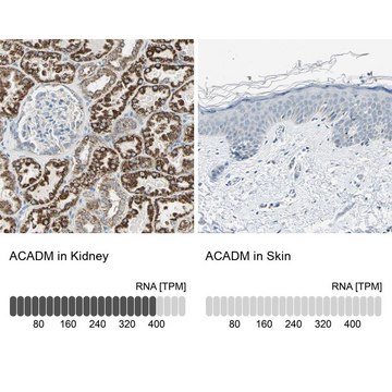 Anti-ACADM antibody produced in rabbit Prestige Antibodies&#174; Powered by Atlas Antibodies, affinity isolated antibody, buffered aqueous glycerol solution