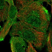 Anti-ARAP1 antibody produced in rabbit Prestige Antibodies® Powered by Atlas Antibodies, affinity isolated antibody