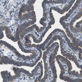 Anti-DENND4C antibody produced in rabbit Prestige Antibodies® Powered by Atlas Antibodies, affinity isolated antibody, buffered aqueous glycerol solution