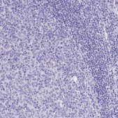 Anti-PLAC1 antibody produced in rabbit Prestige Antibodies® Powered by Atlas Antibodies, affinity isolated antibody, buffered aqueous glycerol solution