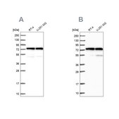 Anti-KARS antibody produced in rabbit Prestige Antibodies® Powered by Atlas Antibodies, affinity isolated antibody, buffered aqueous glycerol solution