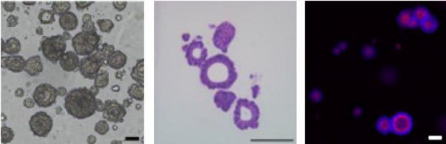 3dGRO&#174; Human CRC Organoids (ISO38)