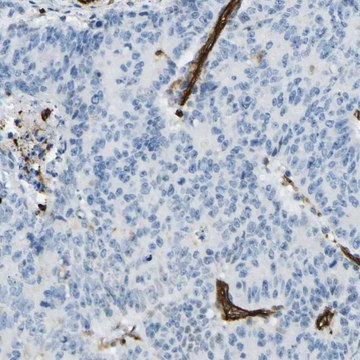 Anti-PLXDC1 antibody produced in rabbit Prestige Antibodies&#174; Powered by Atlas Antibodies, affinity isolated antibody, buffered aqueous glycerol solution