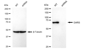 KD-Validated Anti GARS Antibody, clone 23GB5515, Rabbit Monoclonal clone 23GB5515, recombinant rabbit monoclonal, expressed in HEK293 cells