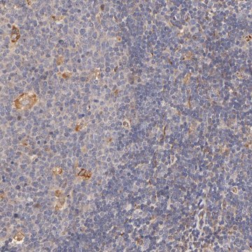 Anti-TNFAIP3 antibody produced in rabbit Prestige Antibodies&#174; Powered by Atlas Antibodies, affinity isolated antibody, buffered aqueous glycerol solution