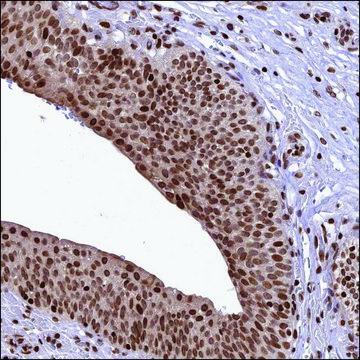 Anti-TET2 antibody produced in rabbit Prestige Antibodies&#174; Powered by Atlas Antibodies, affinity isolated antibody, buffered aqueous glycerol solution