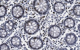 Anti-p-DNA-PKcs-Ser2056 Antibody, clone 1K3 ZooMAb® Rabbit Monoclonal recombinant, expressed in HEK 293 cells